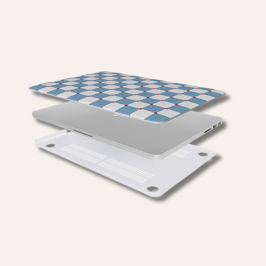 Love Check - Macbook Cover