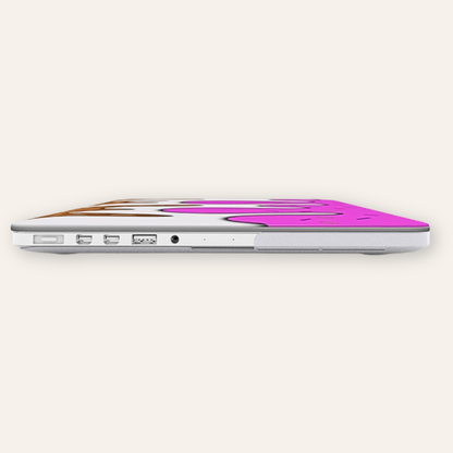Sugar Drip - MacBook Case