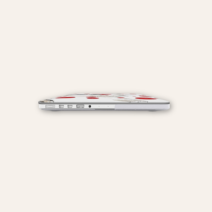 Road Escape - MacBook Case