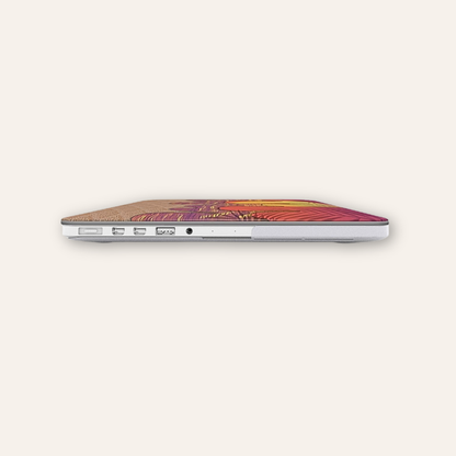 Sunset Drip - MacBook Case